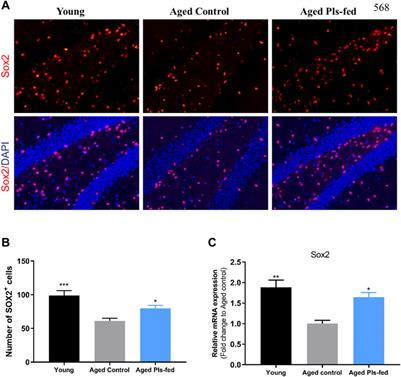 Plasmalogens Eliminate Aging-Associated Synaptic Defects and Microglia-Mediated Neuroinflammation in Mice